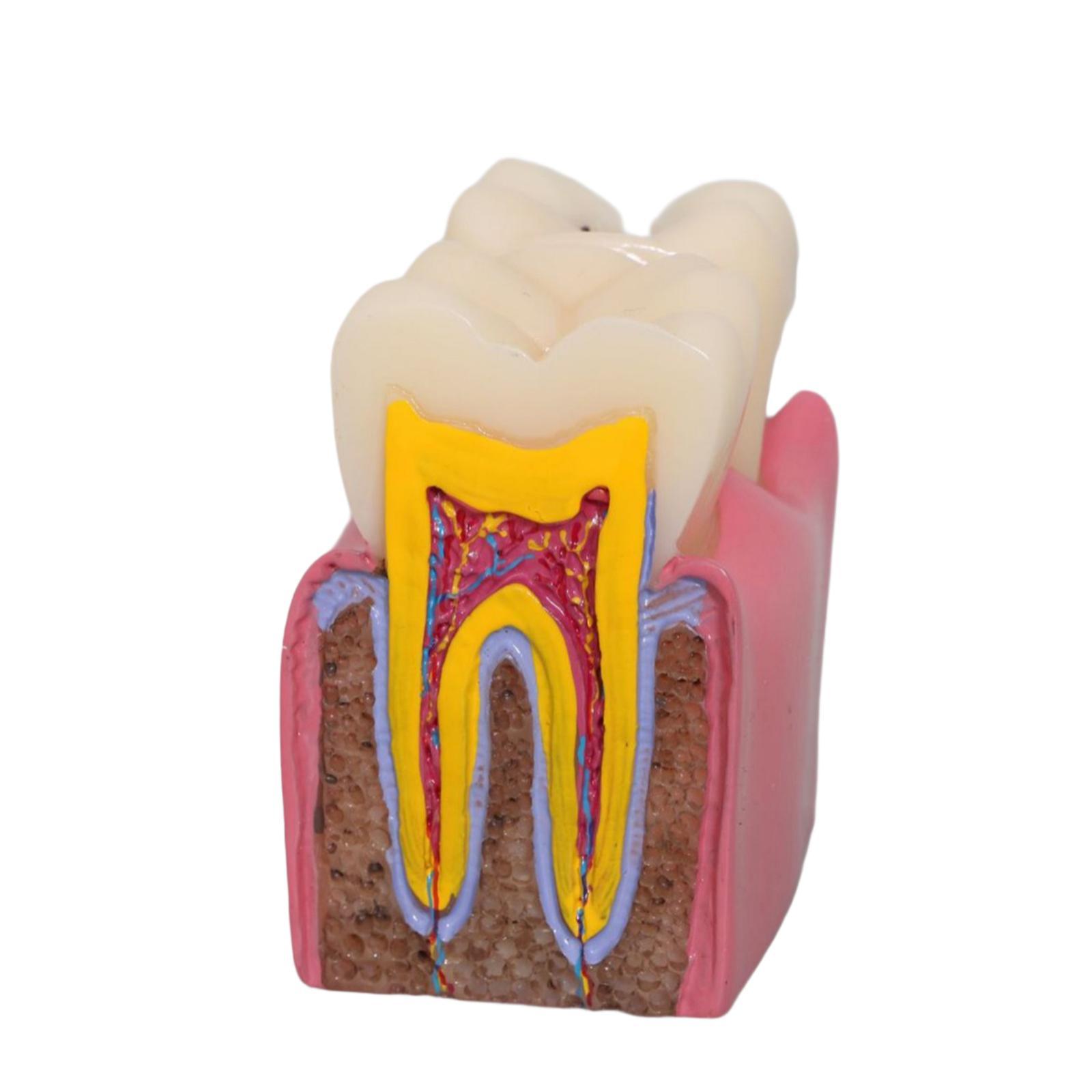 Modello di carie per denti Rad - Kids Education Classes recensione e prezzo